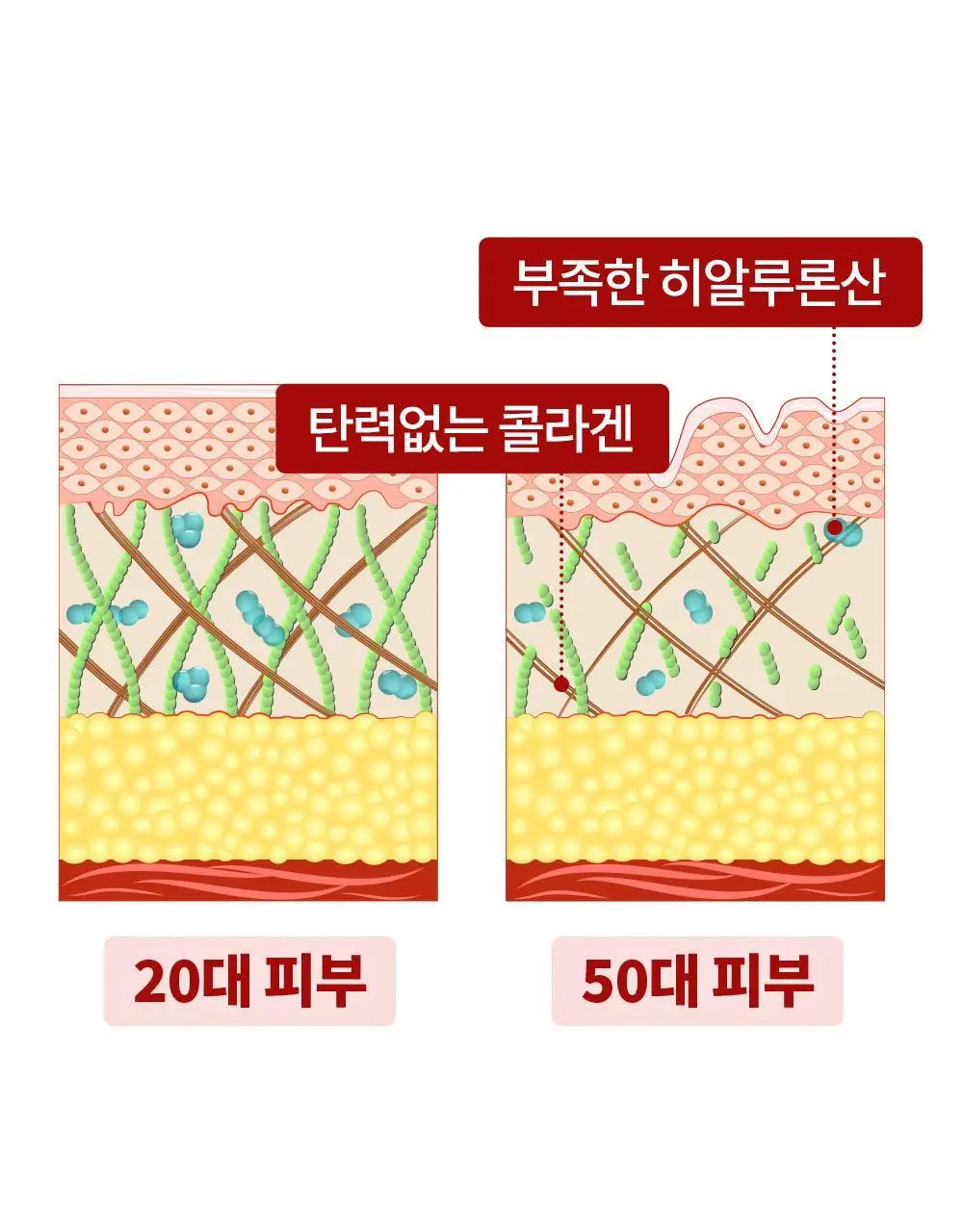 [탄력 리프팅] 메디테라피 링클핏 마스크 7매입 상세페이지 34